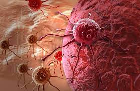 Obat Nano Acura Dikatakan Memiliki Potensi Mengobati Berbagai Jenis Kanker